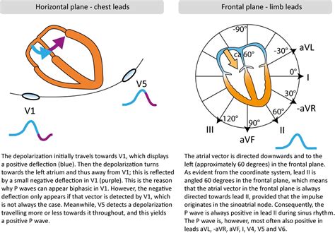 busty mandy ecg|ECG interpretation: Characteristics of the normal ECG (P.